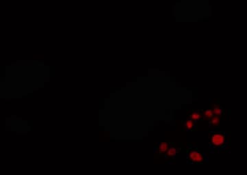ZNF75 / ZNF75D Antibody