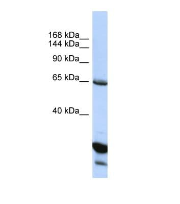 Polyclonal Rabbit anti-Human UNC5H3 / UNC5C Antibody (aa470-519, WB)