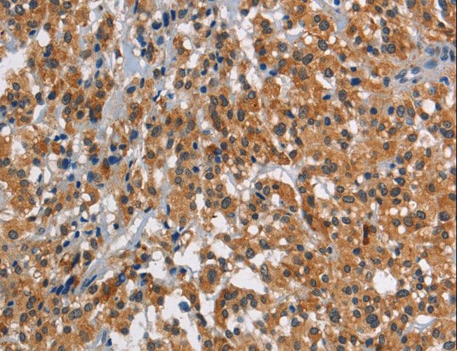 SMAD9 Antibody