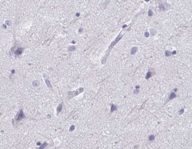 IVL / Involucrin Antibody