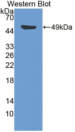 DSTN / Destrin Antibody (aa1-165)