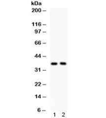 Polyclonal Rabbit anti-Human SFRP-3 / FRZB Antibody (WB)