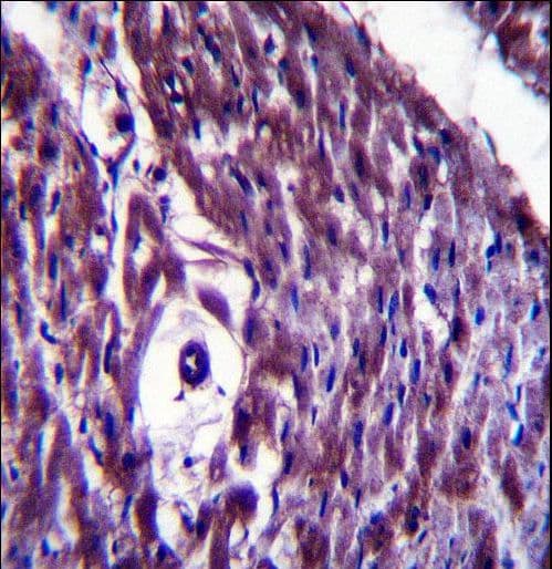 Polyclonal Rabbit anti-Human MAGED4 Antibody (aa328-357, IHC, WB)