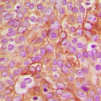 GABRB1 Antibody (C-Terminus)