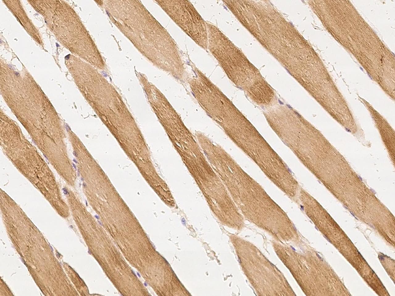 Polyclonal Rabbit anti-Human UCHL3 Antibody (IHC, WB)