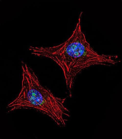 UTY Antibody (aa1247-1276)