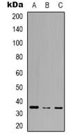 RASD2 Antibody (C-Terminus)