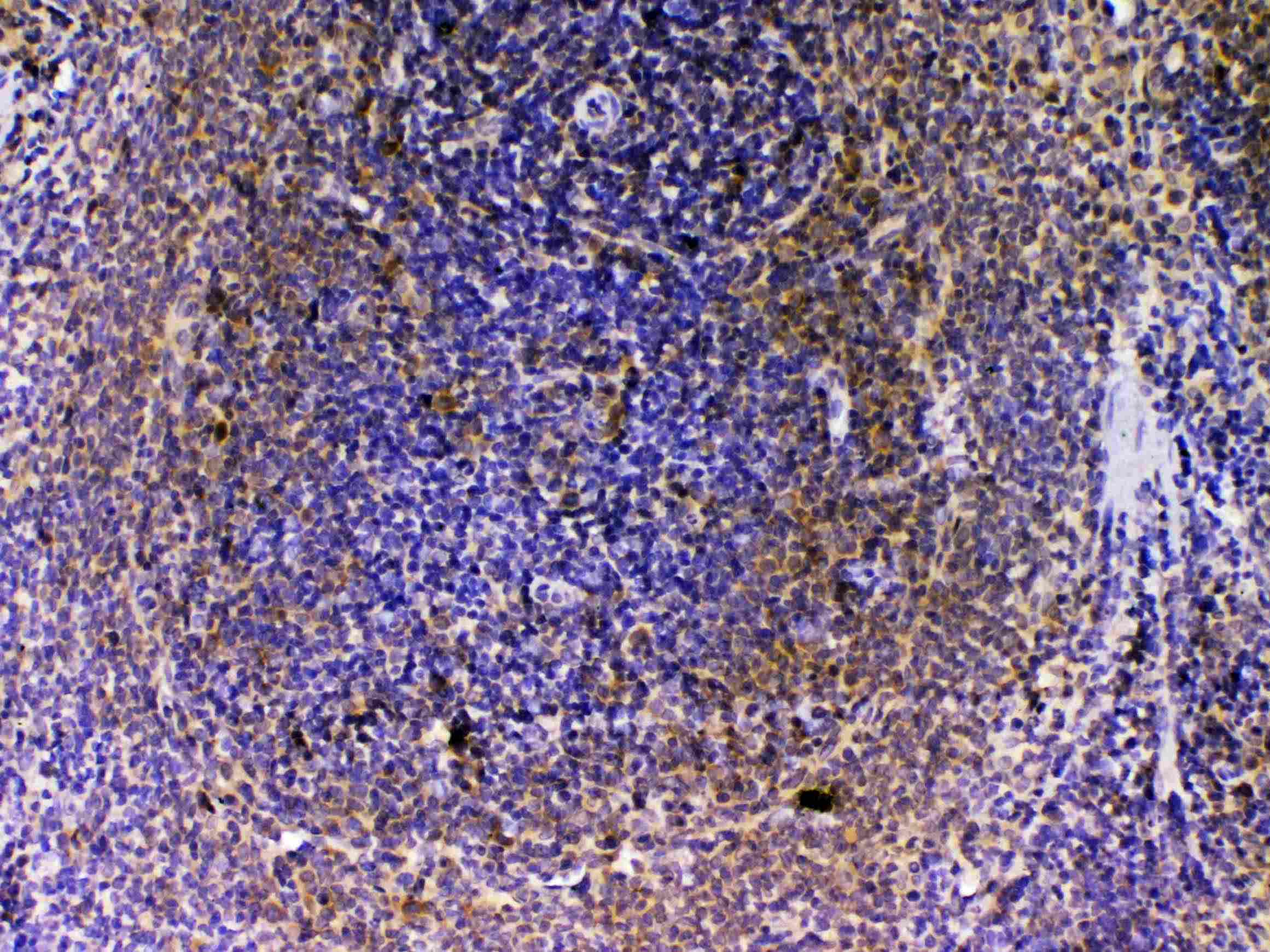 VEGFB Antibody