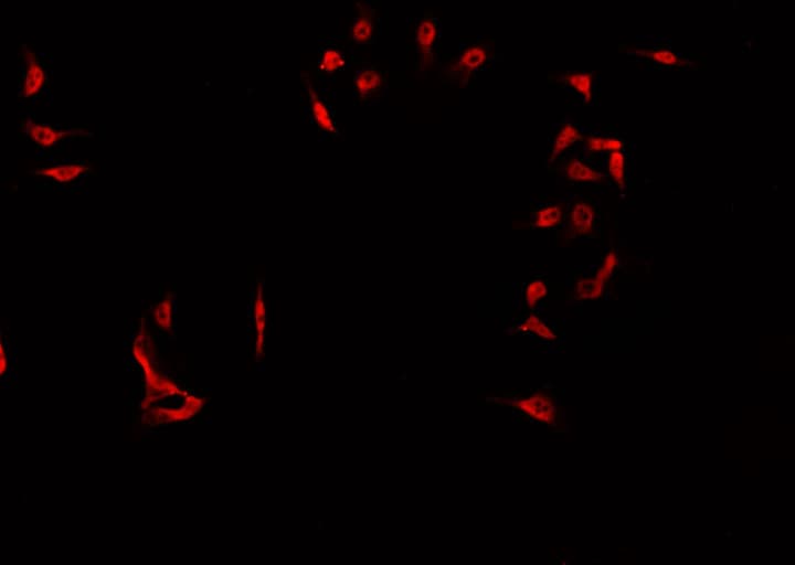 Polyclonal Rabbit anti-Human CCNE2 / Cyclin E2 Antibody (IHC, IF, WB)