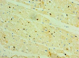 Polyclonal Rabbit anti-Human HSPB2 / HSP27 Antibody (aa1-182, IHC)