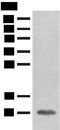 FABP4 / AP2 Antibody