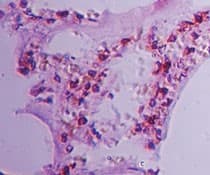 Polyclonal Rabbit anti-Human CLEC1A / CLEC-1 Antibody (aa50-100, IHC, WB)