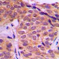 YAP / YAP1 Antibody (Internal)