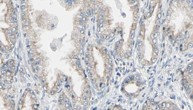 Polyclonal Rabbit anti-Human EIF4EBP1 / 4EBP1 Antibody (IHC, IF, WB)