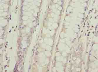 SPCS2 Antibody