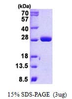 Human MOB1B / MOBKL1A Protein (Recombinant His)