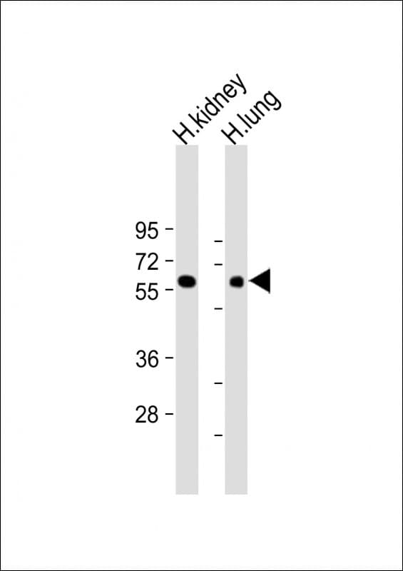 MKS1 Antibody (N-Terminus)