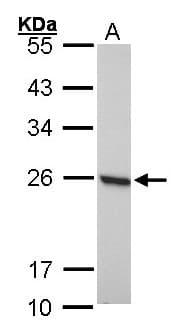 Polyclonal Rabbit anti-Human PRDX1 / Peroxiredoxin 1 Antibody (IF, WB)