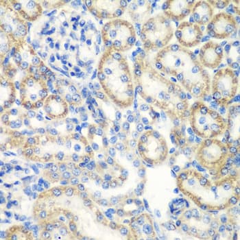 Polyclonal Rabbit anti-Human SMYD1 Antibody (IHC, IF, WB)