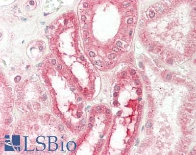 IHC-plus™ Polyclonal Rabbit anti-Human PGD Antibody (aa71-120, IHC, WB)
