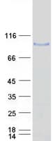 Human ADAM32 Protein (Recombinant Myc-DDK (Flag))