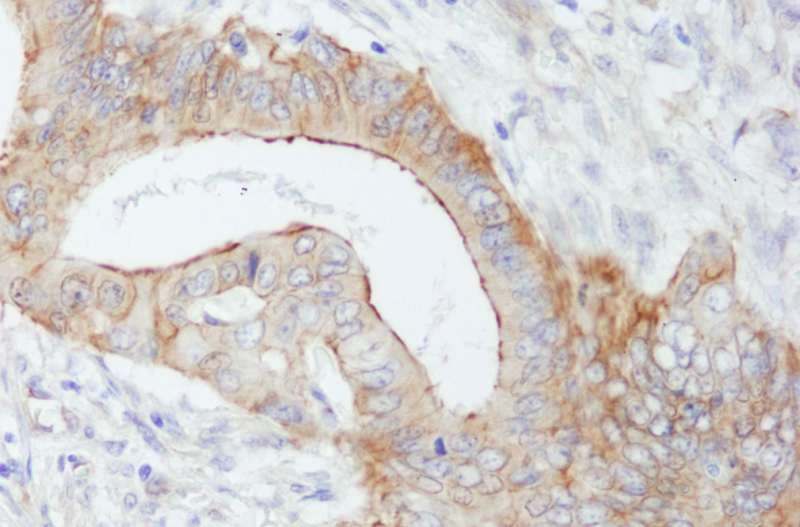 Polyclonal Rabbit anti-Human SPTBN1 / ELF Antibody (aa2150-2200, IHC, WB)