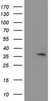 ACY3 Antibody (clone OTI4C1)