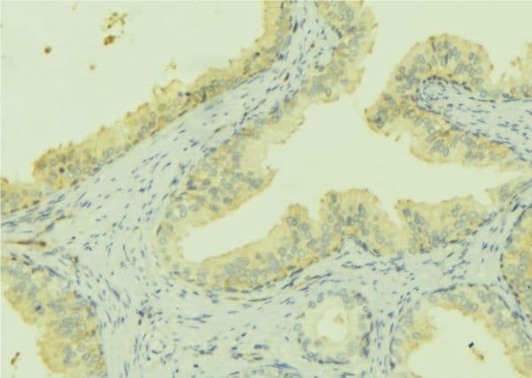 STC2 / Stanniocalcin 2 Antibody