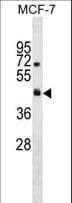 RTN4RL2 Antibody (aa279-308)