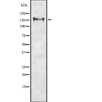 NCAM / CD56 Antibody