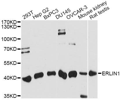 Polyclonal Rabbit anti-Human ERLIN1 / SPFH1 Antibody (WB)