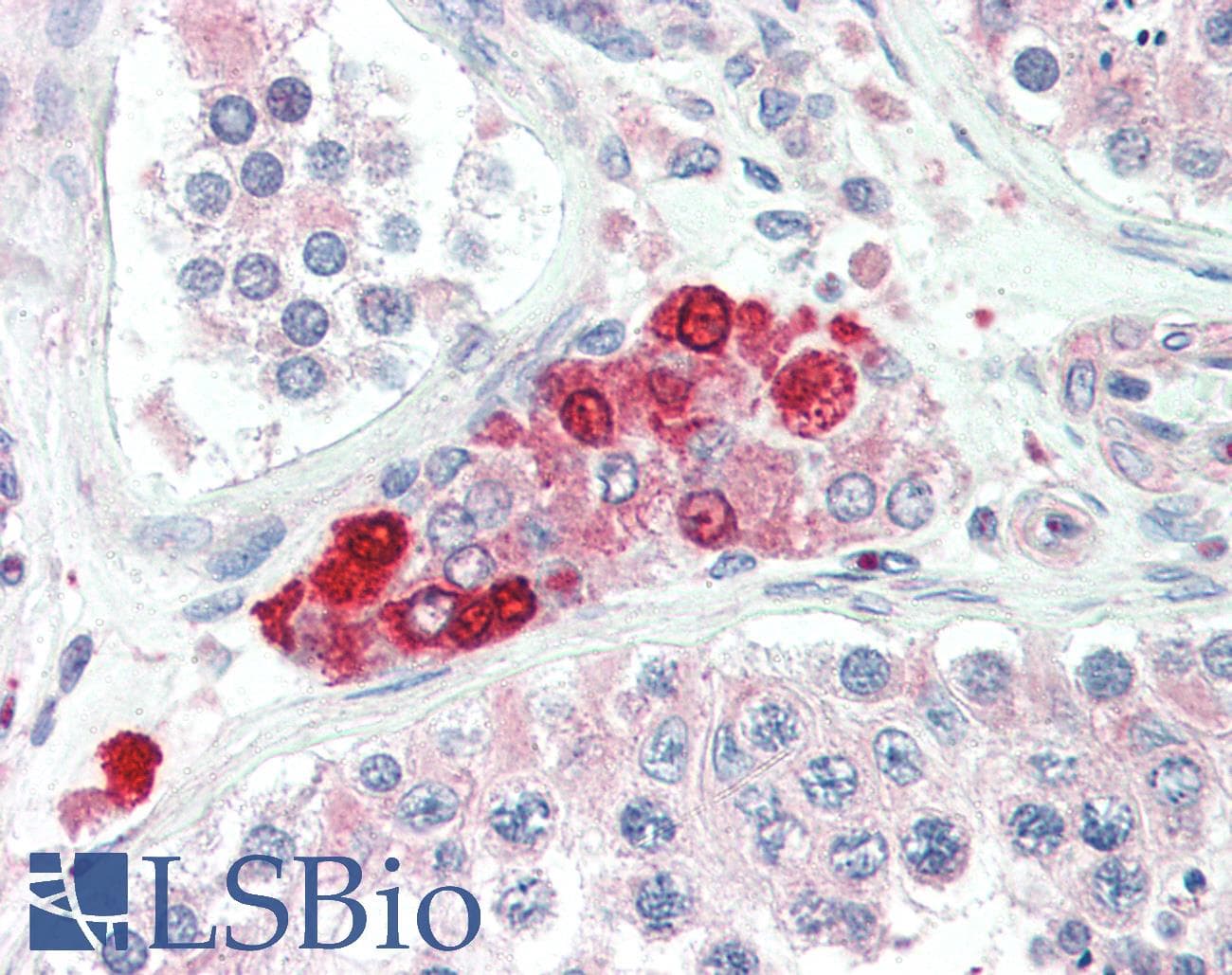 IHC-plus™ IRAK2 / IRAK-2 Antibody