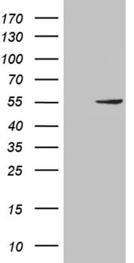 Monoclonal Mouse anti-Human PNLIP / PL / Pancreatic Lipase Antibody (clone OTI5B9, Carrier-free, aa355-465, IHC, WB)
