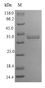 Rat GFER Protein (Recombinant 6His-SUMO, N-terminus)