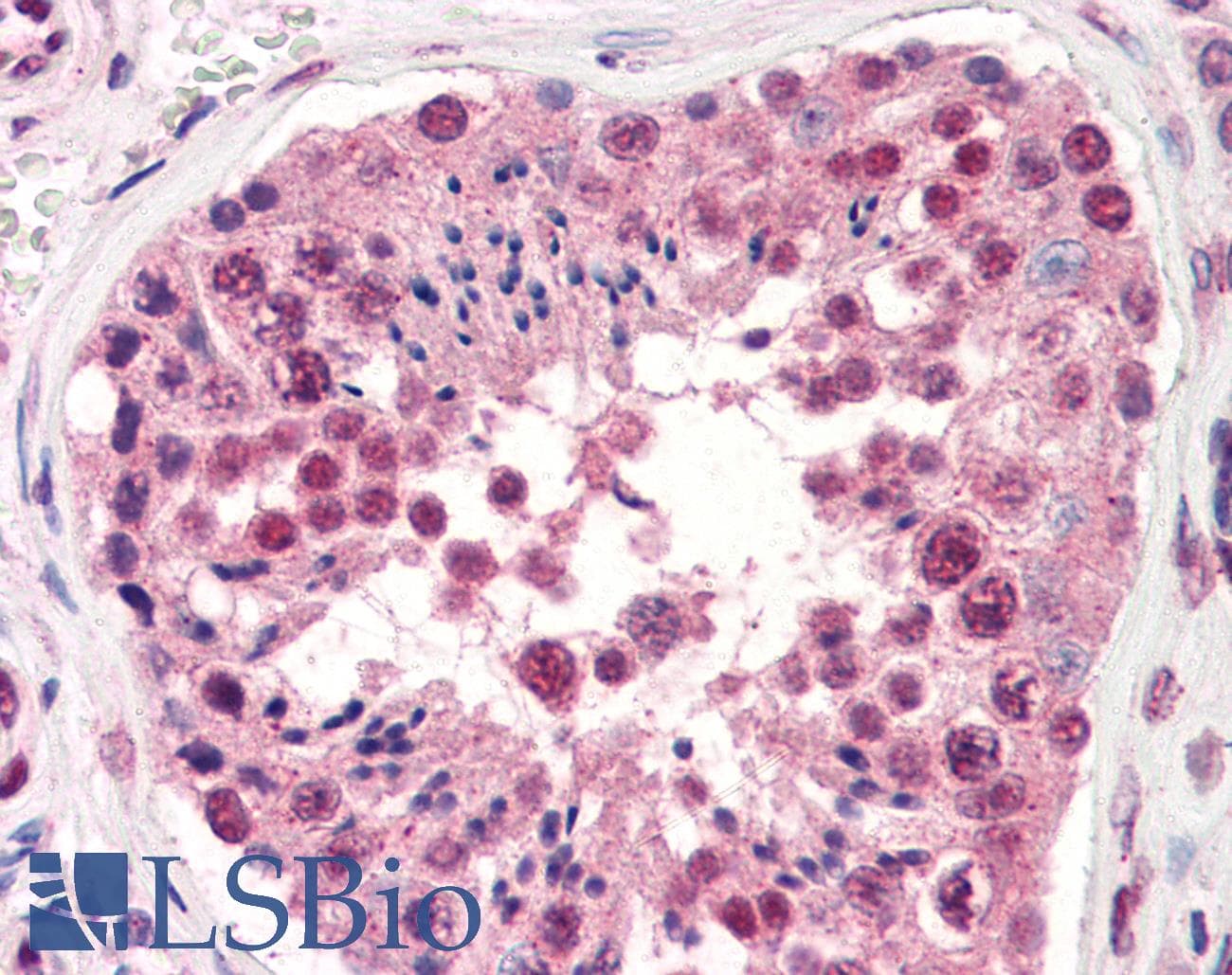 IHC-plus™ TDP-43 / TARDBP Antibody (aa1-260, clone K1B8)