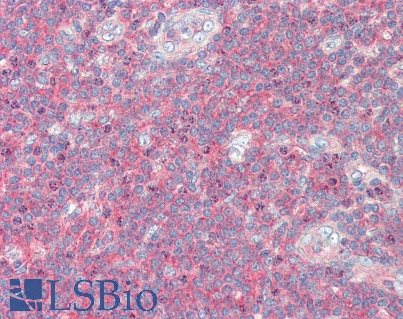 IHC-plus™ TAOK3 / JIK Antibody (aa1-50)