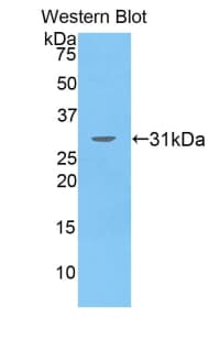 SEPT5 / Septin 5 Antibody (aa77-323, Cy3)