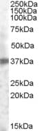 IHC-plus™ Polyclonal Goat anti-Human TROP2 / TACSTD2 Antibody (aa195-208, IHC, WB)