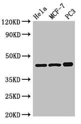 Polyclonal Rabbit anti-Human PRKAR2A Antibody (IHC, IF, WB)