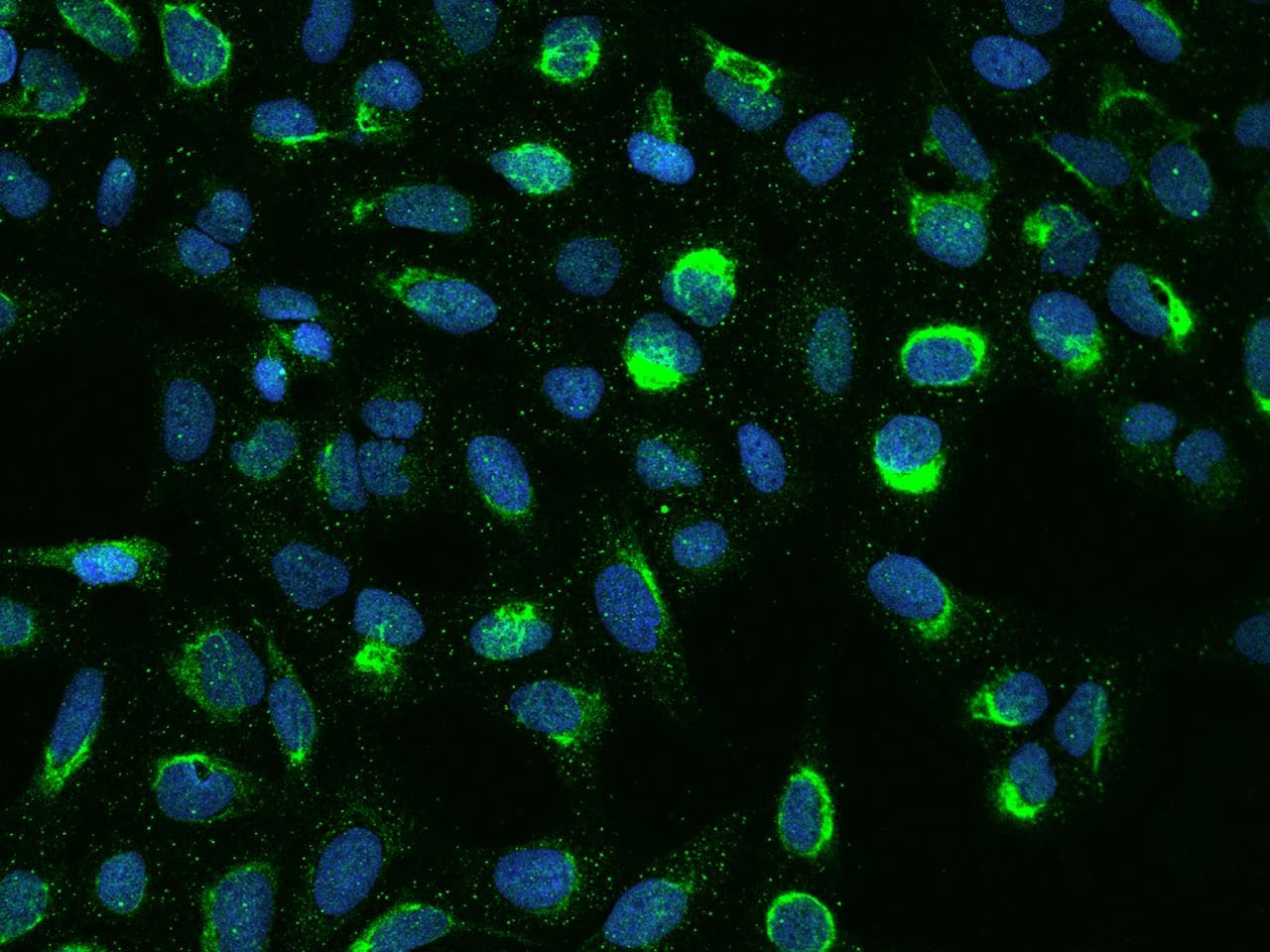 Polyclonal Rabbit anti-Human PDZK1 Antibody (IHC, IF)