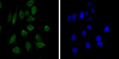 CHD3 Antibody (clone 2G4)
