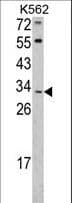 Polyclonal Rabbit anti-Human ITM2A Antibody (aa22-49, WB)