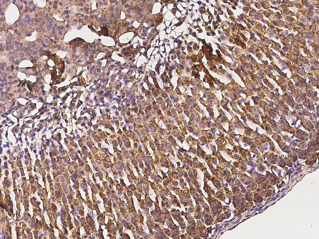 SLC27A3 Antibody (Preservative Free)