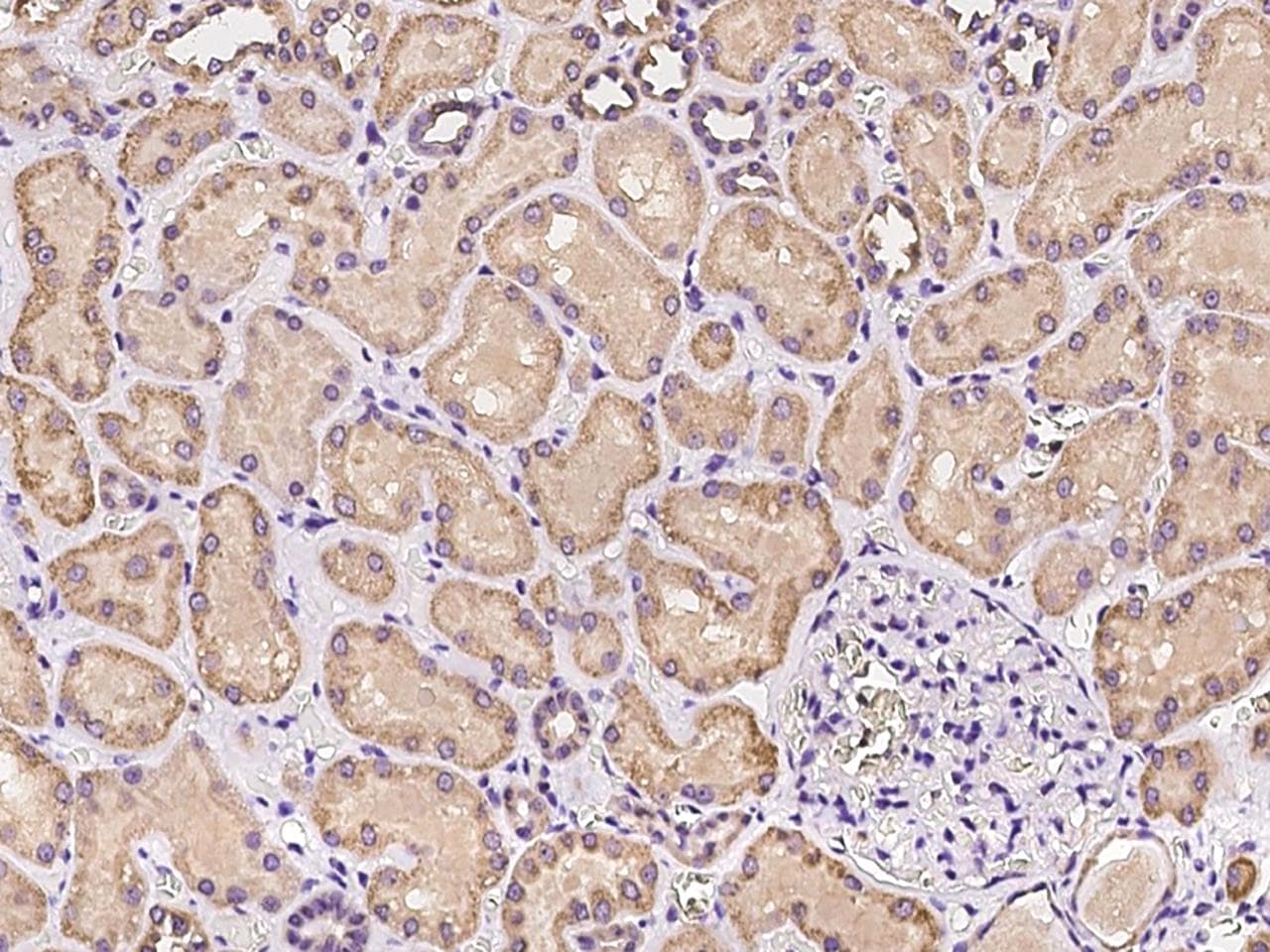 PKD2L2 Antibody