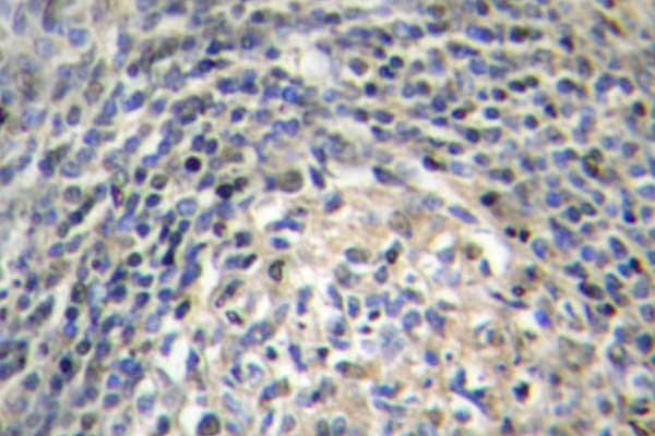 NCF1 / p47phox / p47 phox Antibody (Pro366)