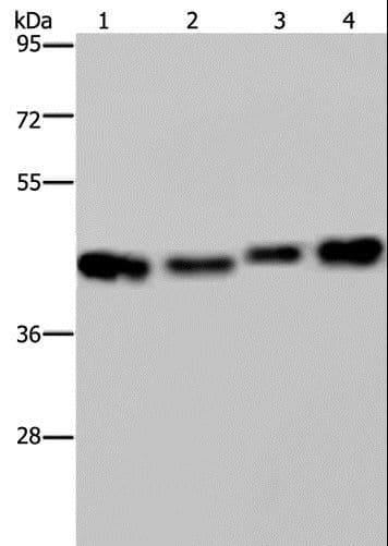 DNAJA1 / HDJ2 Antibody
