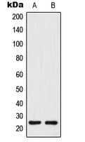 IHC-plus™ CO-029 / TSPAN8 Antibody (Internal)