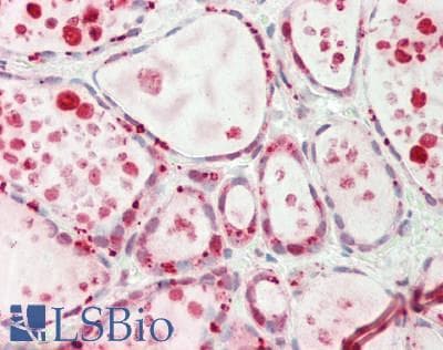 Polyclonal Rabbit anti-Human MINA / MINA53 Antibody (aa374-423, IHC)
