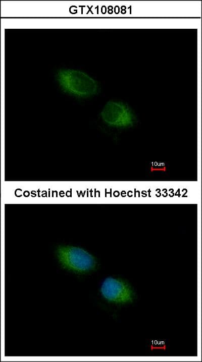 TXNDC1 / TMX1 Antibody (aa219-280)