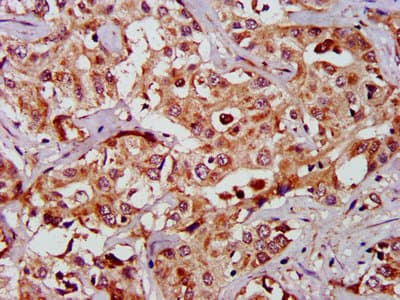 GAS2 Antibody